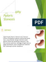 Hypertrophy Pyloric Stenosis