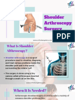 Shoulder Arthroscopy Surgery