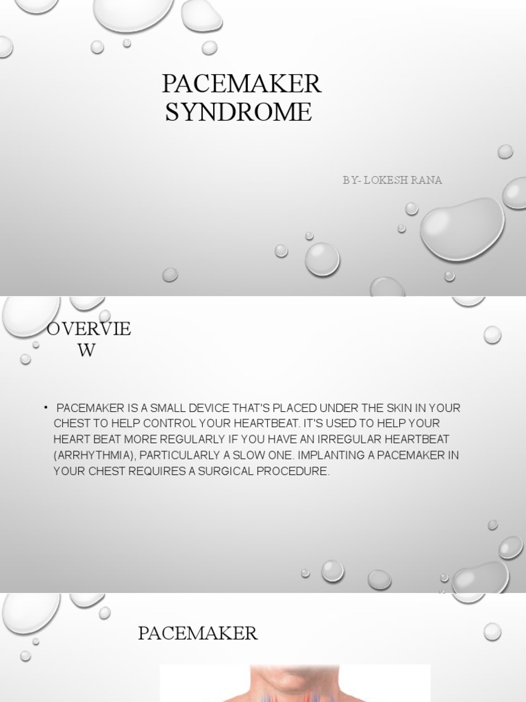 Pacemaker Syndrome | PDF | Artificial Cardiac Pacemaker | Cardiology
