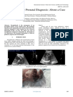 Encephalocele Prenatal Diagnosis About A Case