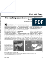 Pictorial Essay: Hysterosalpingography