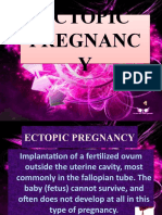 Ectopic Pregnancy&amp;Hmole