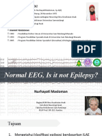 Normal EEG, Is it not Epilepsy tanpa video