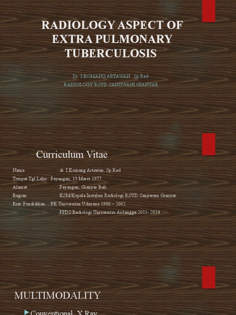 TB Final Revisi | PDF | Tuberculosis | Kidney