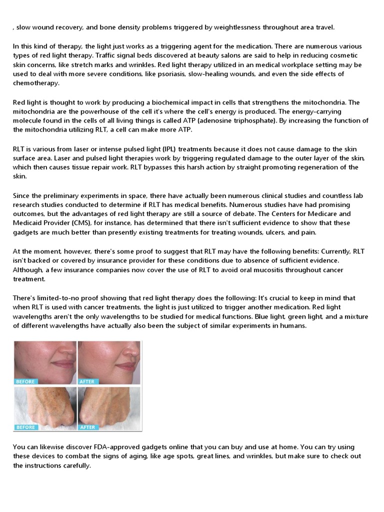 284534red Light Therapy and Syntonics - Sensory Stepping Stones | PDF ...