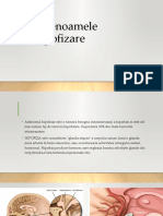 adenoame hipofizare