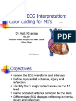 12 Lead ECG Interpretation: Color Coding For MI's: DR Asit Khanna