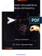 Predicciones Cefalométricas para Cirugía Ortognática