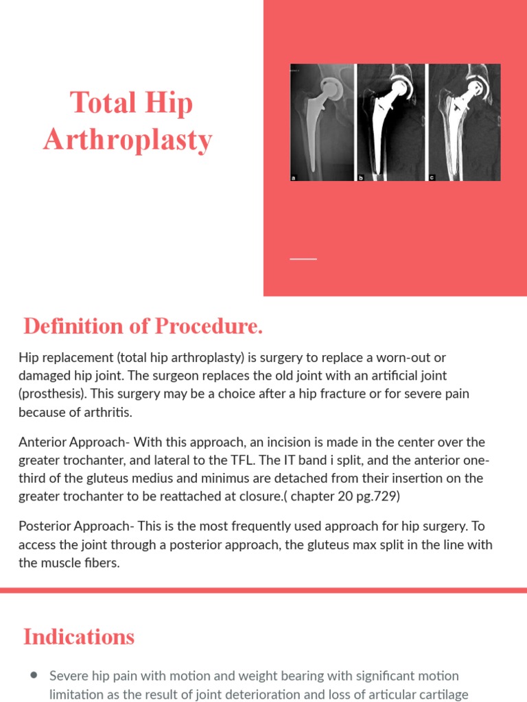 Total Hip Arthroplasty Overview | PDF | Hip | Physical Therapy