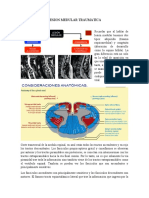 Lesion Medular Traumatica