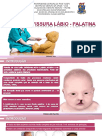 Fissura lábio palatina: cuidados de enfermagem