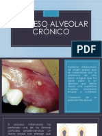 Absceso Alveolar Cronico