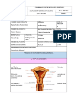 Histerectomia Abdominal Nuevo