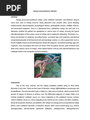 Initial Evaluation of Vertigo