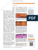 Dermoscopy of Keratosis Pilaris