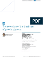 11 Pyloric Stenosis