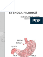 224367169-stenoza-pilorica