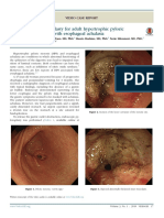 endoscopic-pyloroplasty-for-adult-hypertrophic-pyloric-stenosis-associated-with-esophageal-achalasia