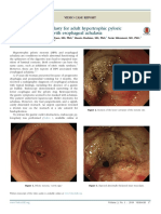 Endoscopic Pyloroplasty For Adult Hypertrophic Pyloric Stenosis Associated With Esophageal Achalasia