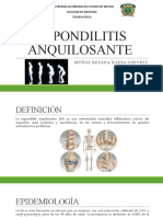 Espondilitis Anquilosante