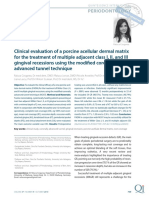 Clinical evaluation of a porcine acellular dermal matrix for the treatment of multiple adjacent class I, II, and III gingival recessions using the modified coronally advanced tunnel technique - Cosgarea 2016