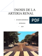 Estenosis Arteria Renal