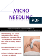 Microneedling 190412120140