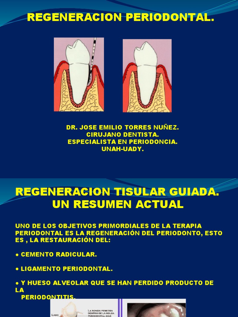 regeneraci-n-tisular-guiada-en-periodoncia-pdf-regeneraci-n