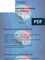 Hematoame Subdurale Versus Epidurale