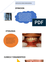 Periodontitis Apical Cronica Granulomatosa