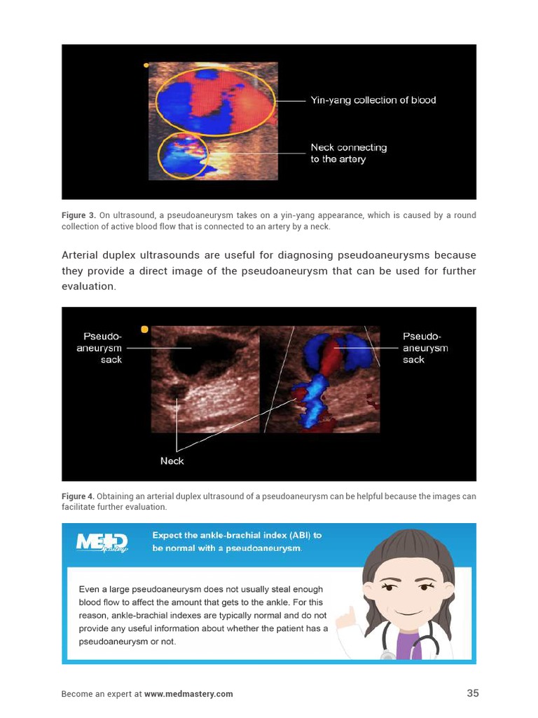 UltrasoundMasterclass - Arteries - of - The - Legs - Handbook 35 | PDF
