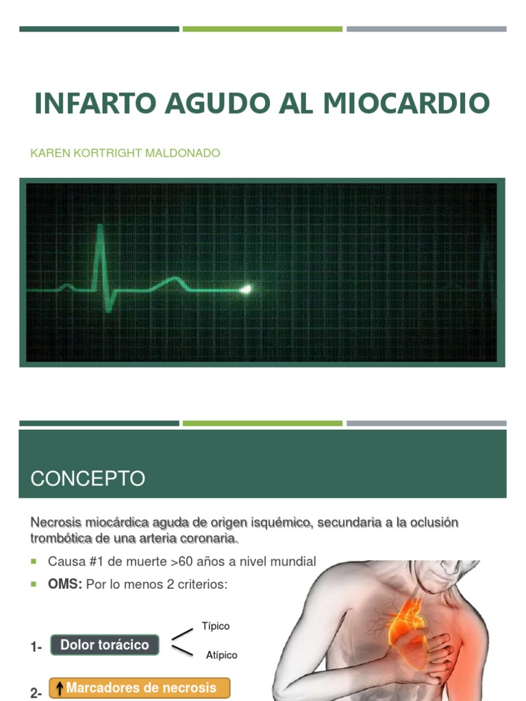 Infarto Agudo Al Miocardio | PDF | Infarto de miocardio ...