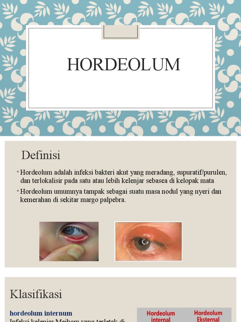 Perbedaan Hordeolum dan Kalazion | PDF | Sains & Matematika