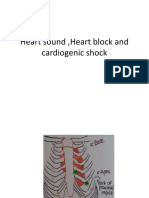 Cardiogenic Shock Nclex