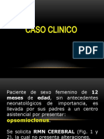 caso clinico OPSOMIOCLONUS