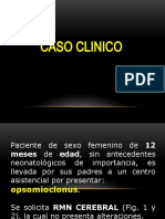 Caso Clinico OPSOMIOCLONUS