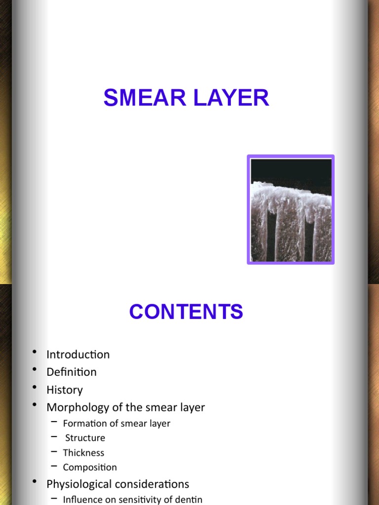 Understanding the Smear Layer in Dentistry | PDF | Dentin | Mouth