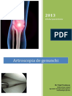 Artroscopie genunchi