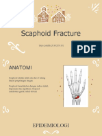 Presus Scaphoid Fracture
