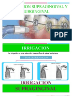 Irrigaccion Supragingival y Subgingival Perio