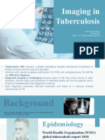 Imaging of Tuberculosis - Rizki Yuda Purnomo