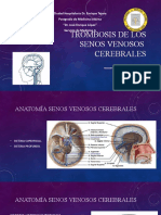 Trombosis de Senos Venosos Cerebrales