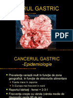 cancer gastric