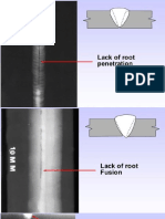 Radiographs_of_Welds_Defect_1621618442