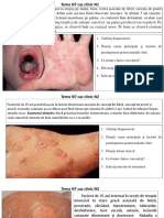 Cazuri Clinice Tema 7 Rectificat