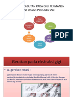 BARU TEKNIK PENCABUTAN PADA GIGI PERMANEN