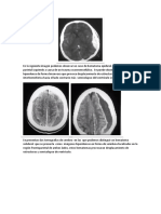 Imagenes Patologicas