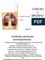 Cancerul Pulmonar