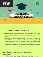 Dsa Cerebral Angiography