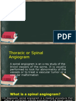 Thoracic Spinal Angiography 4-29-21